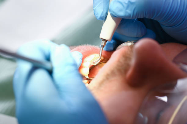 Best Emergency Broken Tooth Repair in Virginia Beach, VA